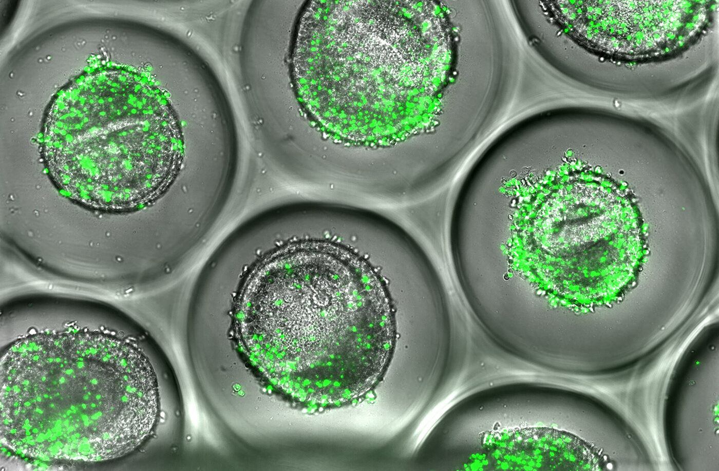 A-List_Liver-organoid-22222-002-e1773770411108